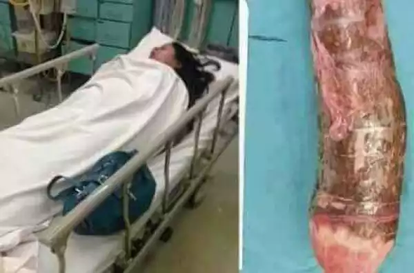 Woman Lands in hospital after 18 inch cassava she was using to mast#rb@te gets stuck in V@g*na
